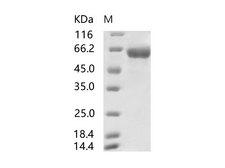 SARS-CoV-2 S2 Protein - Recombinant SARS-CoV Spike S2-His Recombinant Protein