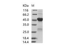 SARS-CoV Nucleoprotein Protein - Recombinant SARS-CoV Nucleoprotein / NP Protein (His Tag)