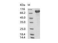 SARS-CoV S1 Protein - Recombinant SARS-CoV S1 Protein (His Tag)(Active)