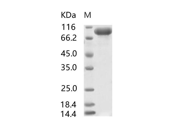 SARS-CoV S1 Protein - Recombinant SARS-CoV S1 Protein, Biotinylated (His Tag)