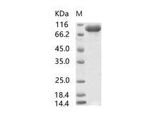 SARS-CoV S1 Protein - Recombinant SARS-CoV S1 Protein, Biotinylated (His Tag)