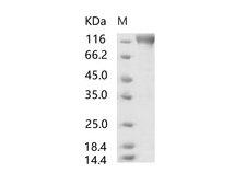 SARS-CoV S1 Protein - Recombinant SARS-CoV S1 Protein (mFc Tag)(Active)