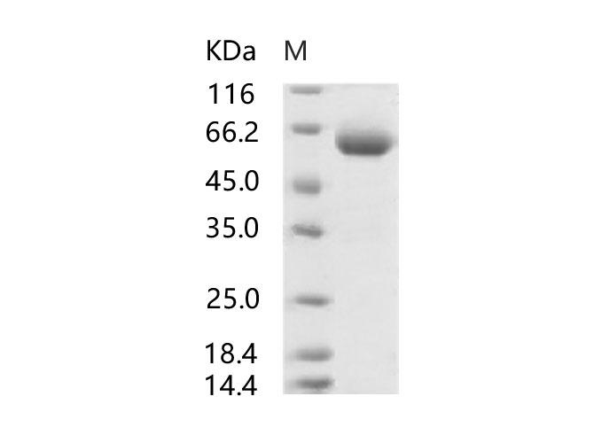 SARS-CoV Spike Glycoprotein Protein - Recombinant SARS-CoV Spike Protein (RBD, mFc Tag)(Active)