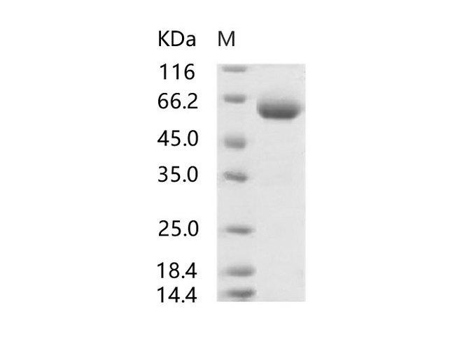 SARS-CoV Spike Glycoprotein Protein - Recombinant SARS-CoV Spike Protein (RBD, mFc Tag)(Active)