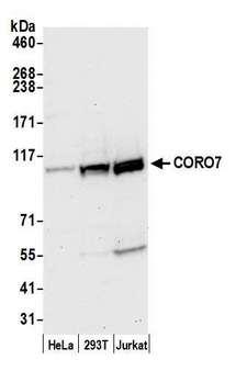 Coronin 7 / CORO7 Antibody - Detection of human CORO7 by western blot. Samples: Whole cell lysate (50 µg) from HeLa, HEK293T, and Jurkat cells prepared using NETN lysis buffer. Antibody: Affinity purified rabbit anti-CORO7 antibody used for WB at 1:1000. Detection: Chemiluminescence with an exposure time of 30 seconds.