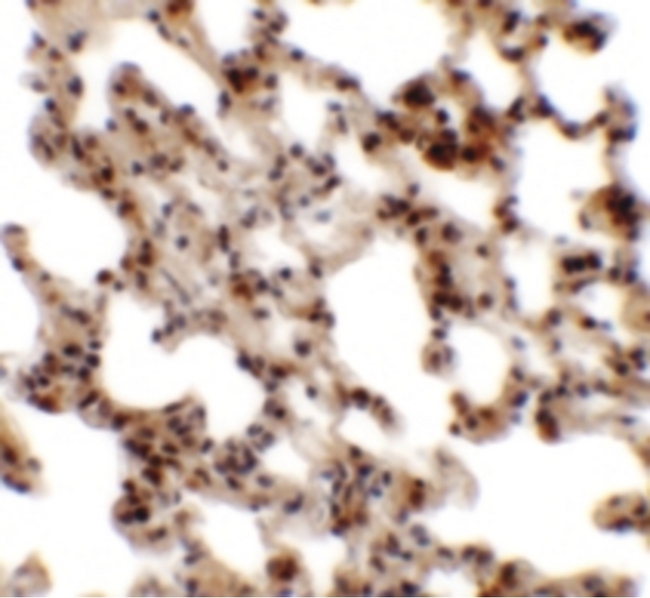 Coronin 7 / CORO7 Antibody - Immunohistochemistry of Coronin 7 in rat lung tissue with Coronin 7 antibody at 2.5 ug/ml.