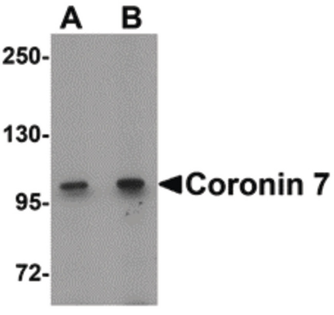 Coronin 7 / CORO7 Antibody - Western blot of Coronin 7 in rat lung tissue lysate with Coronin 7 antibody at (A) 1 and (B) 2 ug/ml.