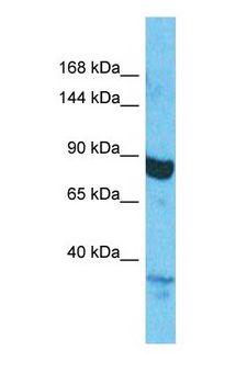Coronin 7 / CORO7 Antibody - Western blot of CORO7 Antibody with human HepG2 Whole Cell lysate.  This image was taken for the unconjugated form of this product. Other forms have not been tested.