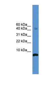 CORT / Cortistatin Antibody - CORT / Cortistatin antibody Western blot of 721_B cell lysate.  This image was taken for the unconjugated form of this product. Other forms have not been tested.