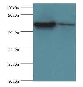 COT / CROT Antibody - Western blot. All lanes: CROT antibody at 3 ug/ml. Lane 1: Mouse kidney tissue. Lane 2: A431 whole cell lysate. Secondary antibody: Goat polyclonal to rabbit at 1:10000 dilution. Predicted band size: 70 kDa. Observed band size: 70 kDa.
