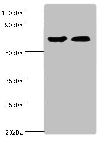 COT / CROT Antibody - Western blot All lanes: CROT antibody at 3µg/ml Lane 1: Mouse kidney tissue Lane 2: A431 whole cell lysate Secondary Goat polyclonal to rabbit IgG at 1/10000 dilution Predicted band size: 71, 11, 74 kDa Observed band size: 71 kDa