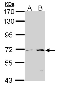 COT / CROT Antibody - Sample (30 ug of whole cell lysate). A:293T, B: A431 . 7.5% SDS PAGE. COT antibody. COT antibody diluted at 1:1000.