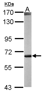 COT / CROT Antibody - Sample (50 ug of whole cell lysate). A: mouse liver. 7.5% SDS PAGE. COT antibody diluted at 1:1000.
