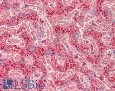COT / CROT Antibody - Human Liver: Formalin-Fixed, Paraffin-Embedded (FFPE)