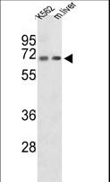 COT / CROT Antibody - Western blot of CROT Antibody in K562 cell line and mouse liver tissue lysates (35 ug/lane). CROT (arrow) was detected using the purified antibody.