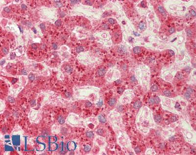 COT / CROT Antibody - Human Liver: Formalin-Fixed, Paraffin-Embedded (FFPE)