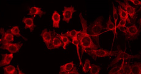 COT / CROT Antibody - Staining HepG2 cells by IF/ICC. The samples were fixed with PFA and permeabilized in 0.1% Triton X-100, then blocked in 10% serum for 45 min at 25°C. The primary antibody was diluted at 1:200 and incubated with the sample for 1 hour at 37°C. An Alexa Fluor 594 conjugated goat anti-rabbit IgG (H+L) Ab, diluted at 1/600, was used as the secondary antibody.