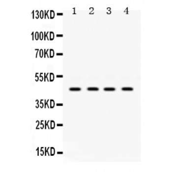 COUP-TFII / NR2F2 Antibody - NR2F2 antibody Western blot. All lanes: Anti NR2F2 at 0.5 ug/ml. Lane 1: Rat Liver Tissue Lysate at 50 ug. Lane 2: HELA Whole Cell Lysate at 40 ug. Lane 3: A431 Whole Cell Lysate at 40 ug. Lane 4: SW620 Whole Cell Lysate at 40 ug. Predicted band size: 46 kD. Observed band size: 46 kD.
