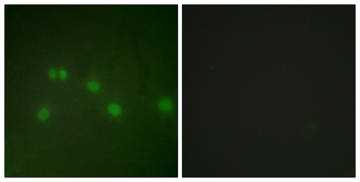 COUP-TFII / NR2F2 Antibody - Immunofluorescence analysis of HUVEC cells, using COT2 Antibody. The picture on the right is blocked with the synthesized peptide.