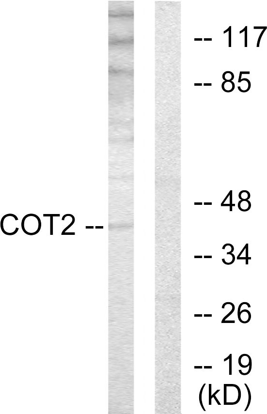 COUP-TFII / NR2F2 Antibody - Western blot analysis of lysates from HUVEC cells, using COT2 Antibody. The lane on the right is blocked with the synthesized peptide.