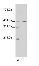 COUP-TFII / NR2F2 Antibody - A: Marker, B: Transfected 293T Cell Lysate.  This image was taken for the unconjugated form of this product. Other forms have not been tested.