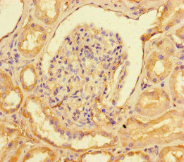 COUP-TFII / NR2F2 Antibody - Immunohistochemistry of paraffin-embedded human kidney tissue at dilution of 1:100