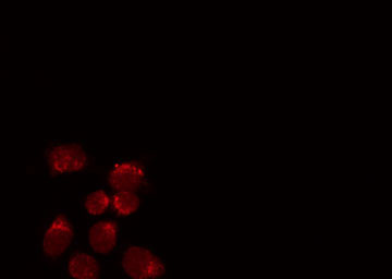 COUP-TFII / NR2F2 Antibody - Staining HuvEc cells by IF/ICC. The samples were fixed with PFA and permeabilized in 0.1% Triton X-100, then blocked in 10% serum for 45 min at 25°C. The primary antibody was diluted at 1:200 and incubated with the sample for 1 hour at 37°C. An Alexa Fluor 594 conjugated goat anti-rabbit IgG (H+L) Ab, diluted at 1/600, was used as the secondary antibody.