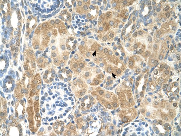 COUP-TFII / NR2F2 Antibody - NR2F2 antibody NR2F2(nuclear receptor subfamily 2, group F, member 2) Antibody was used in IHC to stain formalin-fixed, paraffin-embedded human kidney.  This image was taken for the unconjugated form of this product. Other forms have not been tested.