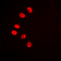 COUP-TFII / NR2F2 Antibody - Immunofluorescent analysis of NR2F2 staining in HeLa cells. Formalin-fixed cells were permeabilized with 0.1% Triton X-100 in TBS for 5-10 minutes and blocked with 3% BSA-PBS for 30 minutes at room temperature. Cells were probed with the primary antibody in 3% BSA-PBS and incubated overnight at 4 deg C in a humidified chamber. Cells were washed with PBST and incubated with a DyLight 594-conjugated secondary antibody (red) in PBS at room temperature in the dark. DAPI was used to stain the cell nuclei (blue).