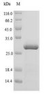 ASIP Protein - (Tris-Glycine gel) Discontinuous SDS-PAGE (reduced) with 5% enrichment gel and 15% separation gel.