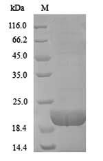 CD8A / CD8 Alpha Protein - (Tris-Glycine gel) Discontinuous SDS-PAGE (reduced) with 5% enrichment gel and 15% separation gel.