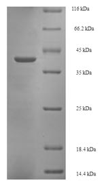 GLTP Protein - (Tris-Glycine gel) Discontinuous SDS-PAGE (reduced) with 5% enrichment gel and 15% separation gel.