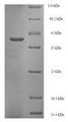 GLTP Protein - (Tris-Glycine gel) Discontinuous SDS-PAGE (reduced) with 5% enrichment gel and 15% separation gel.