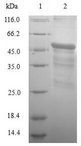 IFNW1 Protein - (Tris-Glycine gel) Discontinuous SDS-PAGE (reduced) with 5% enrichment gel and 15% separation gel.