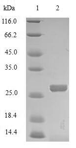 MBL Protein - (Tris-Glycine gel) Discontinuous SDS-PAGE (reduced) with 5% enrichment gel and 15% separation gel.