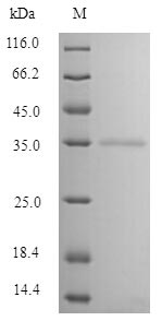 MBL Protein - (Tris-Glycine gel) Discontinuous SDS-PAGE (reduced) with 5% enrichment gel and 15% separation gel.