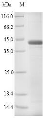 PAG1 / PSPB Protein - (Tris-Glycine gel) Discontinuous SDS-PAGE (reduced) with 5% enrichment gel and 15% separation gel.