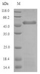 PTX3 / Pentraxin 3 Protein - (Tris-Glycine gel) Discontinuous SDS-PAGE (reduced) with 5% enrichment gel and 15% separation gel.