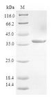 S100A9 / MRP14 Protein - (Tris-Glycine gel) Discontinuous SDS-PAGE (reduced) with 5% enrichment gel and 15% separation gel.