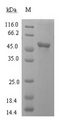 SEPP1 / Selenoprotein P Protein - (Tris-Glycine gel) Discontinuous SDS-PAGE (reduced) with 5% enrichment gel and 15% separation gel.