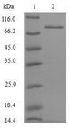 SFTPC / Surfactant Protein C Protein - (Tris-Glycine gel) Discontinuous SDS-PAGE (reduced) with 5% enrichment gel and 15% separation gel.