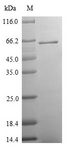 SV2A / SV Protein - (Tris-Glycine gel) Discontinuous SDS-PAGE (reduced) with 5% enrichment gel and 15% separation gel.