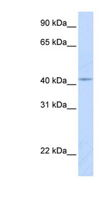 COX10 Antibody - COX10 antibody Western blot of Fetal Lung lysate. This image was taken for the unconjugated form of this product. Other forms have not been tested.