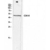 COX10 Antibody - Western blot of COX10 antibody