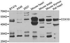 COX10 Antibody - Western blot analysis of extracts of various cell lines.