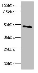 COX10 Antibody - Western blot All Lanes: COX10 antibody at 5.31ug/ml+ Mouse gonadal tissue Goat polyclonal to rabbit at 1/10000 dilution Predicted band size: 49,28 kDa Observed band size: 49 kDa