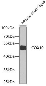 COX10 Antibody - Western blot analysis of extracts of mouse esophagus using COX10 Polyclonal Antibody at dilution of 1:1000.