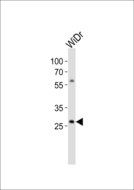COX11 Antibody - Western blot of lysate from WiDr cell line with COX11 Antibody. Antibody was diluted at 1:1000. A goat anti-rabbit IgG H&L (HRP) at 1:10000 dilution was used as the secondary antibody. Lysate at 20 ug.