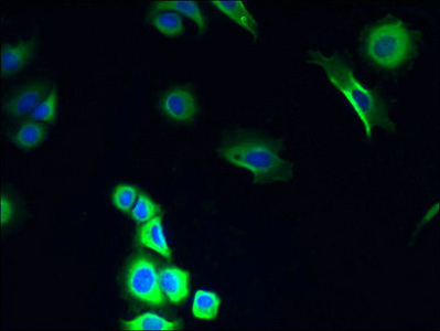 COX11 Antibody - Immunofluorescent analysis of MCF-7 cells using COX11 Antibody at dilution of 1:100 and Alexa Fluor 488-congugated AffiniPure Goat Anti-Rabbit IgG(H+L)