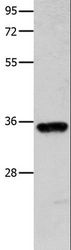 COX11 Antibody - Western blot analysis of Mouse brain tissue, using COX11 Polyclonal Antibody at dilution of 1:600.